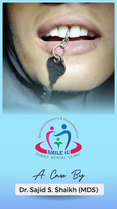 A Clinical Case by Dr Sajid Shaikh - treatment video at Smile 4U Family Dental Clinic, Kurla