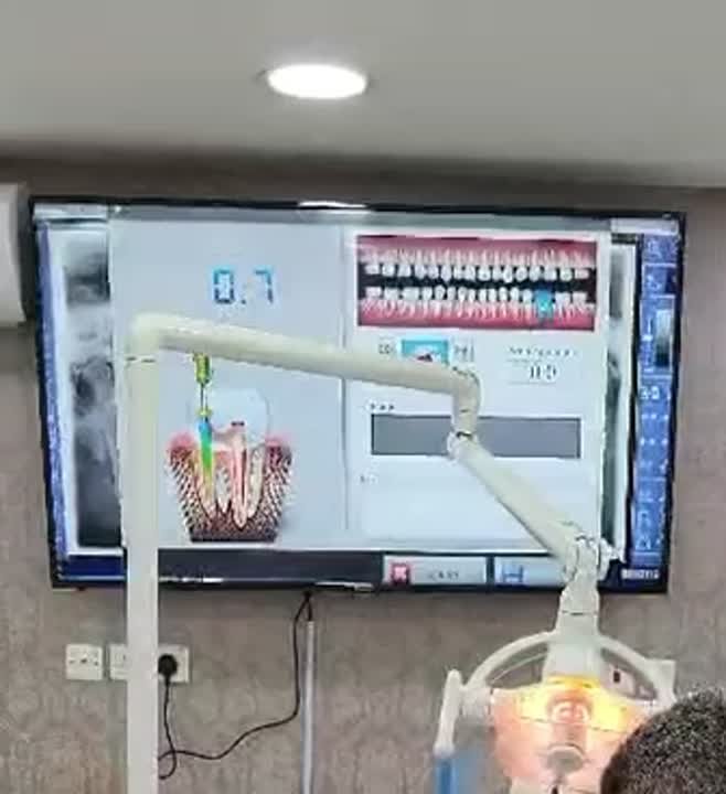 Digital Root Canal Treatment - treatment video at Smile 4U Family Dental Clinic, Kurla