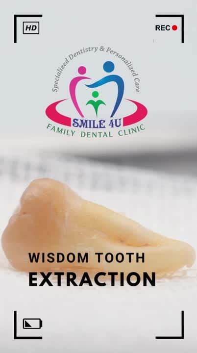 Wisdom Tooth Removal - treatment video at Smile 4U Family Dental Clinic, Kurla