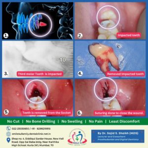 dentist in Kurla, Mumbai