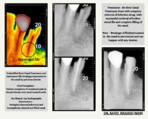 dentist in Kurla, Mumbai