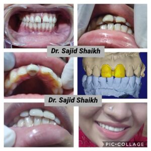 dentist in Kurla, Mumbai