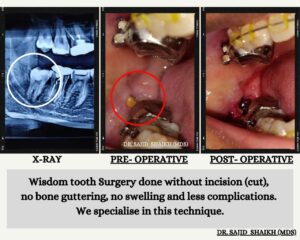 dentist in Kurla, Mumbai