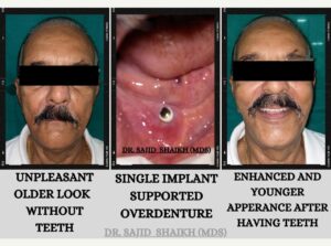 dentist in Kurla, Mumbai