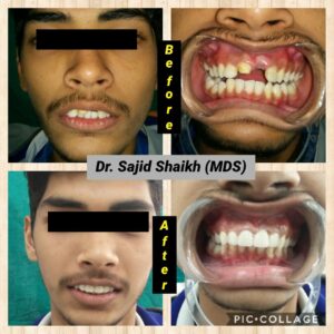 oral surgeon in Mumbai