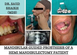 oral surgeon in Mumbai