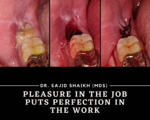 Cosmetic dentist in Mumbai