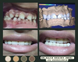 dentist in Mumbai