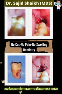 dentist in Kurla, Mumbai