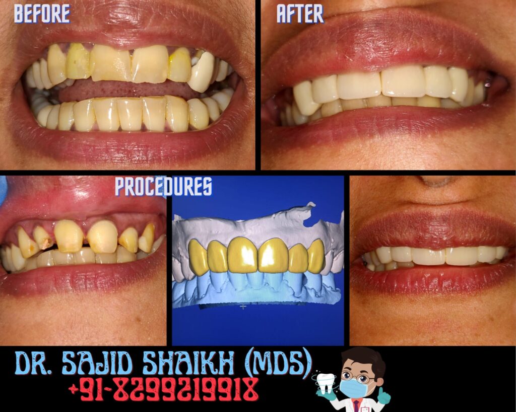 dentist in Kurla, Mumbai