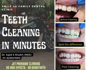 Teeth cleaning in Mumbai