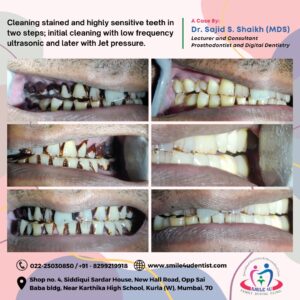 dental clinic in Mumbai