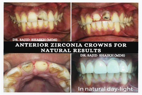 Cosmetic dentist in Mumbai