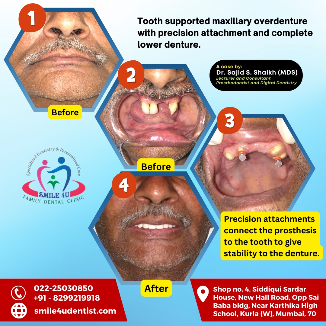 A complete teeth denture, and tooth implant clinic in Kurla, Mumbai