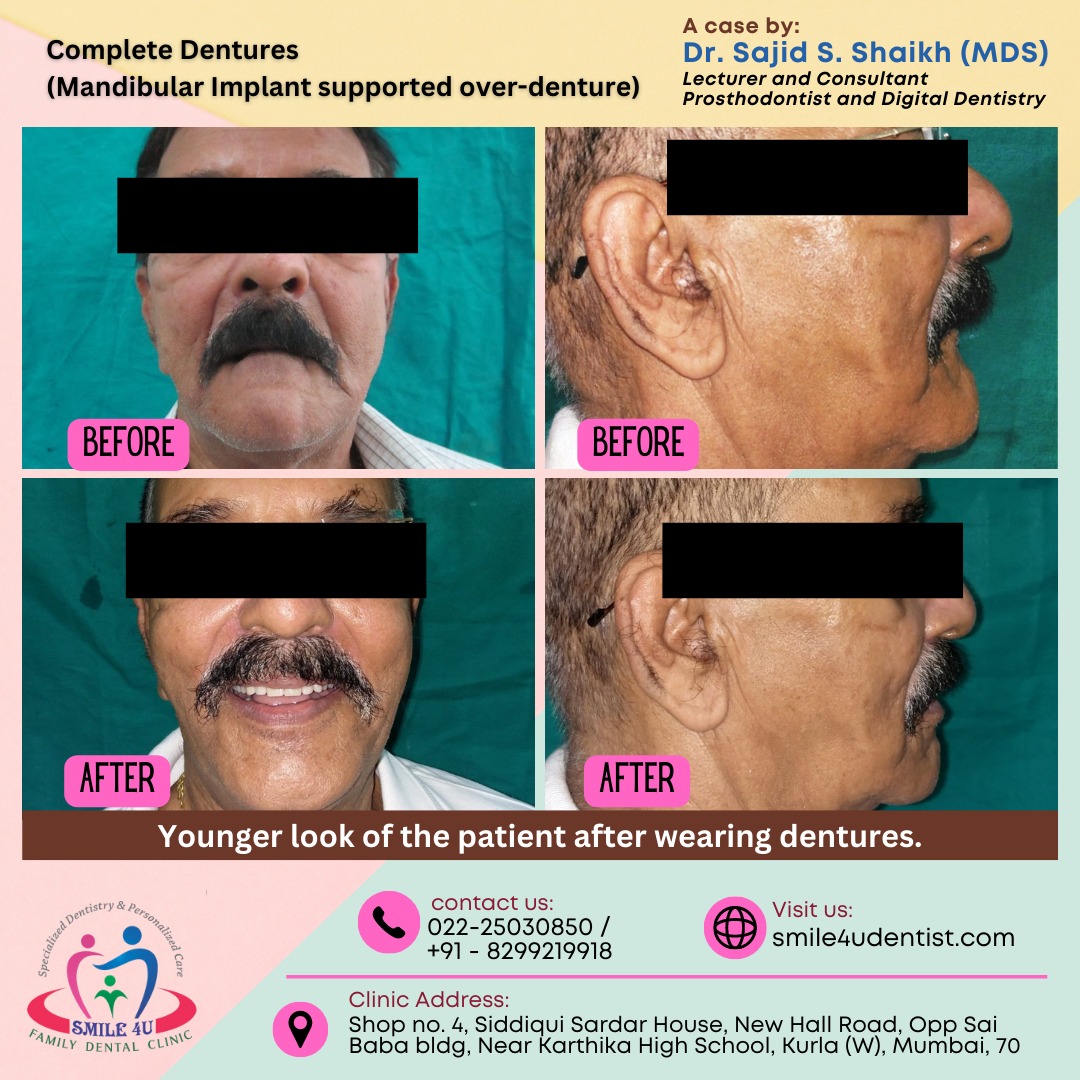 A complete teeth denture, and tooth implant clinic in Kurla, Mumbai
